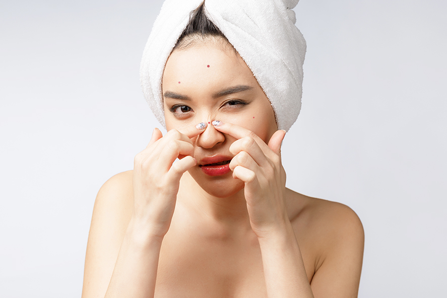 10 Things You Need To Know About Acne