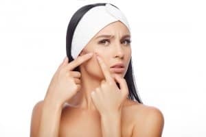 Best Anti Acne Tips Singapore