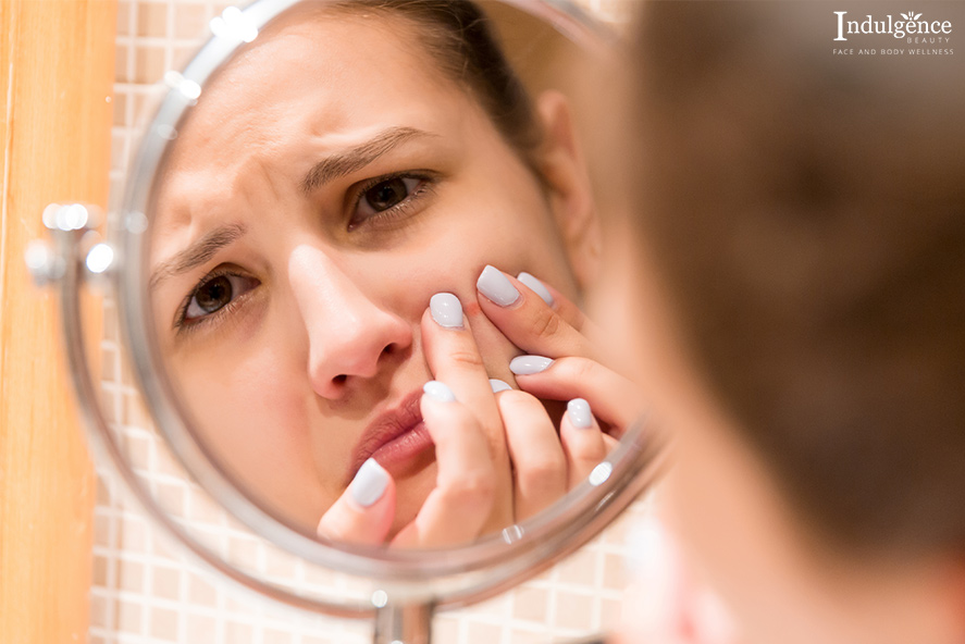 5 Common Myths About Acne & How Going For An Extraction Facial Helps