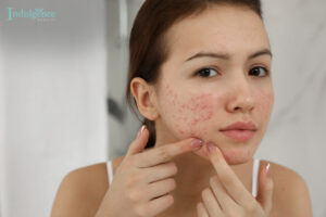 DIY vs professional extraction